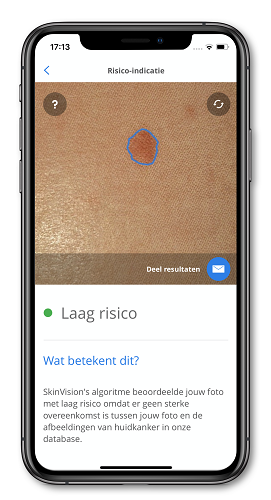Skinvision, Uw Zorg online, app,